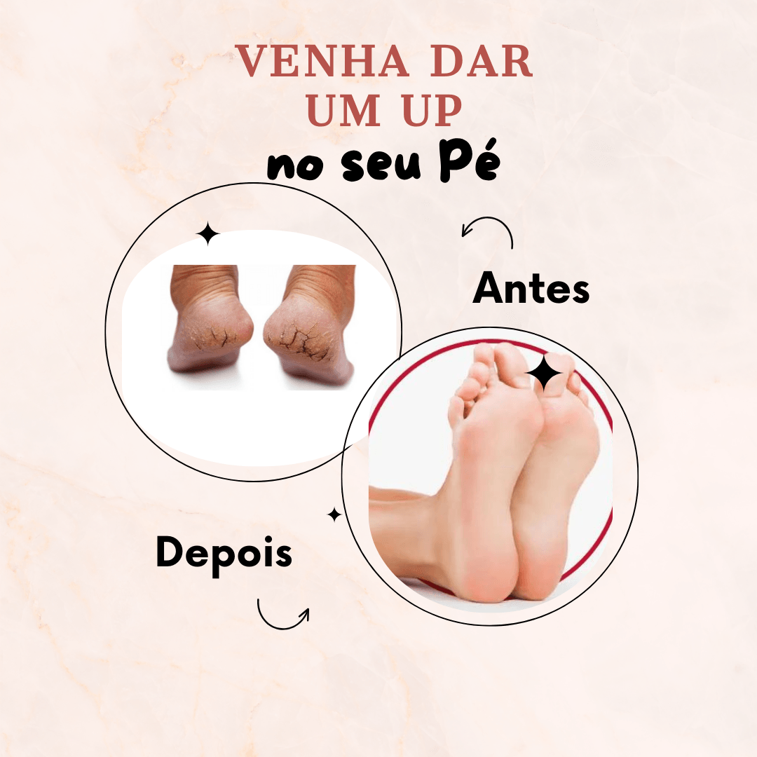 Creme Removedor de Rachaduras do Pé - Tartaruga Shop